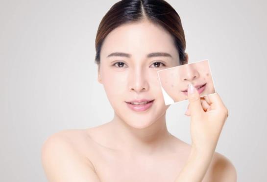 為什么刷酸之后毛孔特別大?刷酸后起密密麻麻的小疙瘩怎么辦?