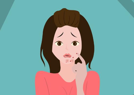 鼻子上長(zhǎng)膿包痘多久會(huì)消?眉毛長(zhǎng)痘痘怎么辦?