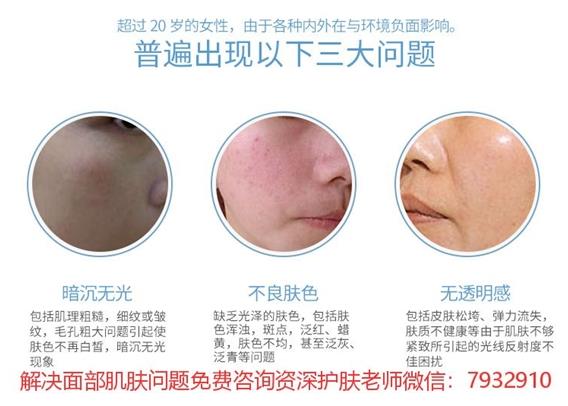 祛痘護膚有什么比較好的產品推薦?朵嘉濃祛痘凝膠