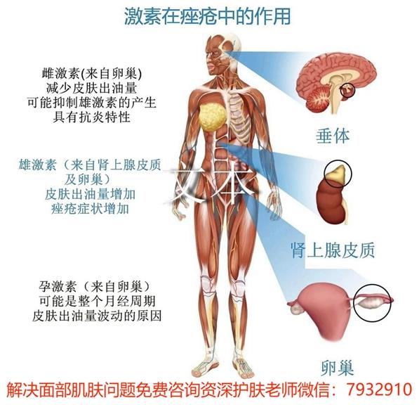 學生祛痘無需天價,只需朵嘉濃祛痘凝膠即可