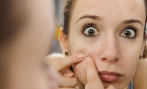 臉上為什么會長粉刺呢 正確去除粉刺的方法