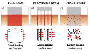 香蜜麗格黎京雄院長Fotona 4D魅眼光雕祛除黑眼圈