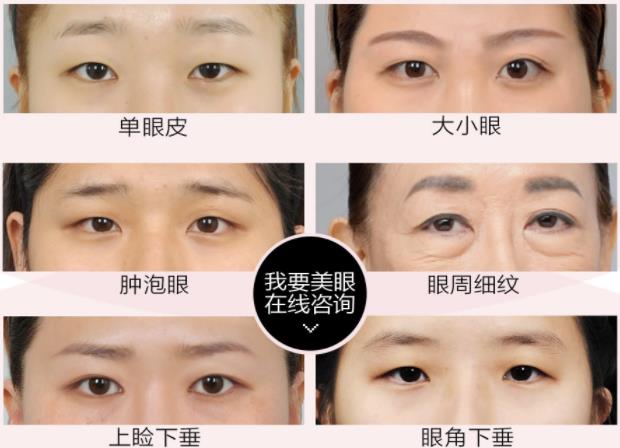 深圳軍科整形做雙眼皮咋樣 每個愛美女孩都應該來的地方