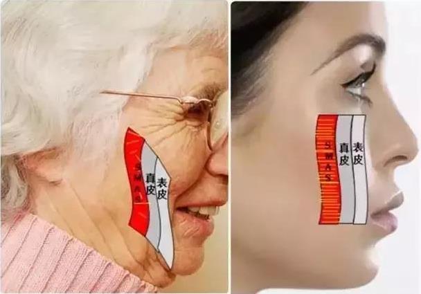 成都嬌點整形胡浪熱提拉:不被年齡限制 活出自己想要的精彩