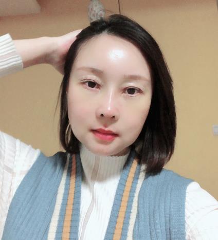 青島華韓整形美容醫院員工體驗 面部填充 隆鼻和美眼術