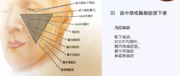 北京伊美爾幸福醫(yī)院姚紅偉:超聲刀和線雕哪個(gè)更好