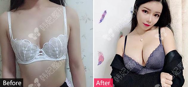 廣州韓妃整形專家楊德發(fā),20年專研探索女人弧度之美