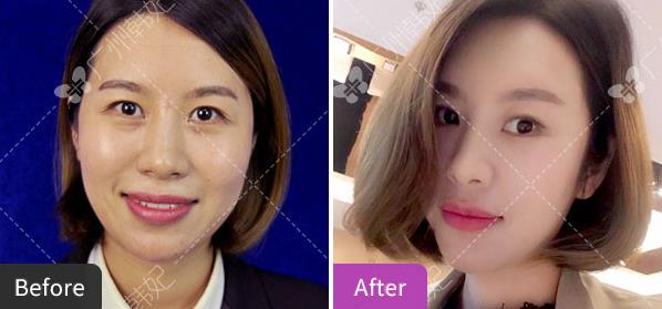 廣州韓妃整形專家楊德發(fā),20年專研探索女人弧度之美