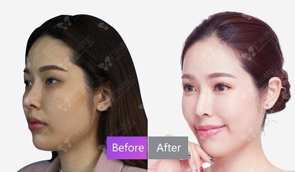 廣州韓妃整形專家楊德發(fā),20年專研探索女人弧度之美