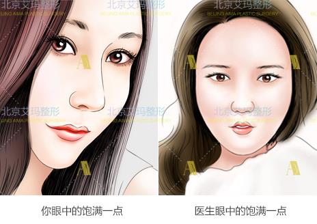 面部填充失敗的原因是什么?又該如何修復?韋元強分析