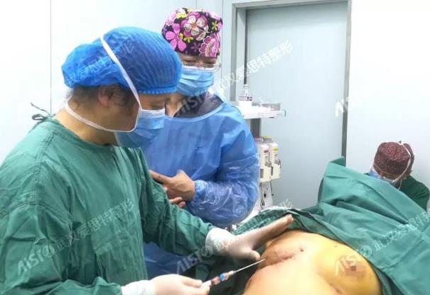 愛(ài)思特張敏邁阿密乳房再造口碑如何,有案例嗎?