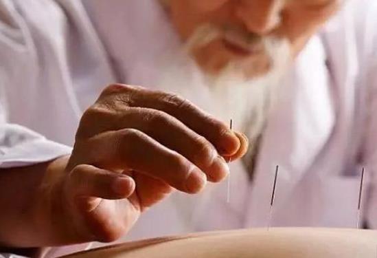 針灸減肥每天都要扎嗎?針灸減肥和埋線減肥的區別