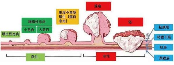 武漢漢西博仕肛腸醫(yī)院好不好 定期做肛腸檢查 可有效排查腸癌風險