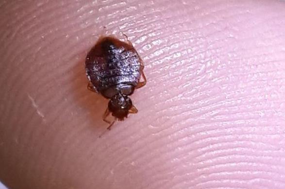 頭上有虱子怎么去除掉?虱子是怎么長出來的?虱子和跳蚤區別