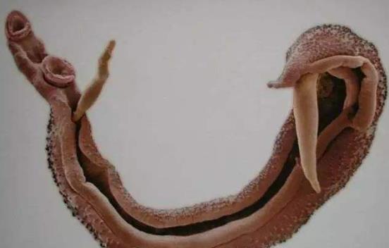 引發(fā)直腸癌的的原因有哪些?怎么預(yù)防直腸癌?