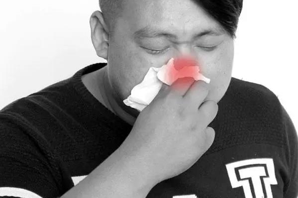 保定民眾耳鼻喉醫院治療鼻炎 河北鼻炎排名第一的醫院