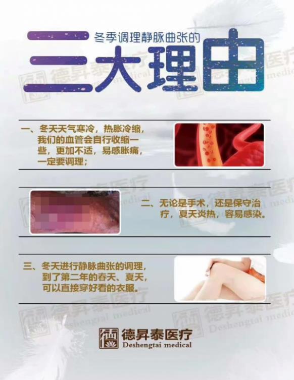 曲康健提醒靜脈曲張朋友們,這幾點一定要做好