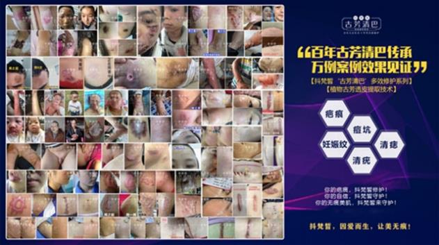 抖梵皙疤痕修護事業萬億市場來襲