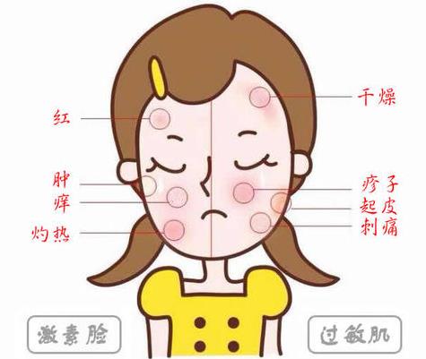 過敏了臉紅腫癢怎么辦?朵嘉濃真的能修復嗎?