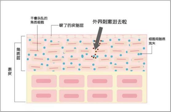 過敏了臉紅腫癢怎么辦?朵嘉濃真的能修復嗎?