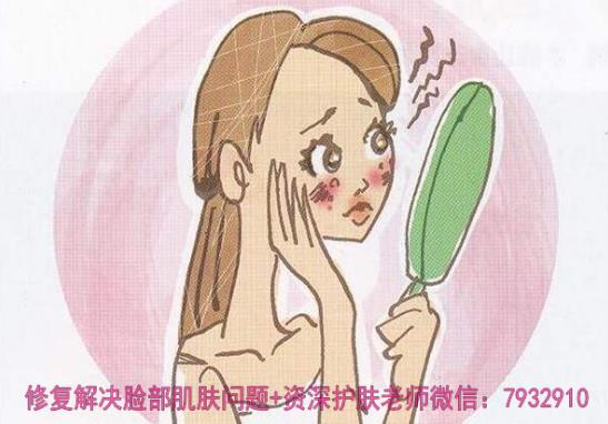 比較安全的祛痘印產品:朵嘉濃到底能修復皮膚嗎?