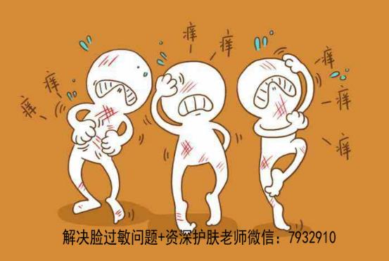 換季臉過敏發(fā)紅怎么辦?好的敏感肌膚護膚品哪種好?