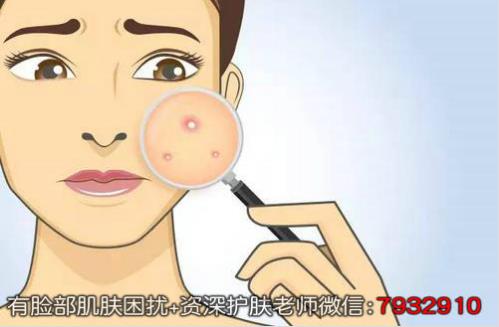 淡斑祛痘印哪個產品好?朵嘉濃怎么樣?