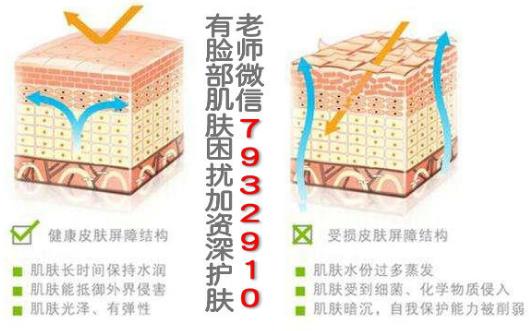 我的臉過敏了怎么辦啊?臉過敏后毛孔粗大如何解決?