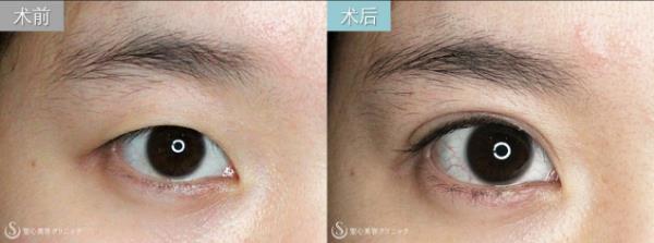 日式整形醫生解析:如何擁有日本女明星般的日式精致臉?