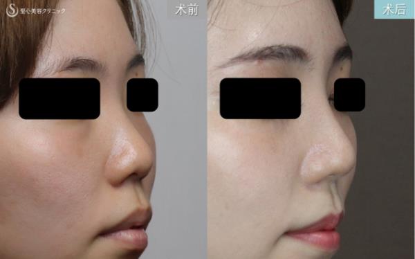 日式整形醫生解析:如何擁有日本女明星般的日式精致臉?