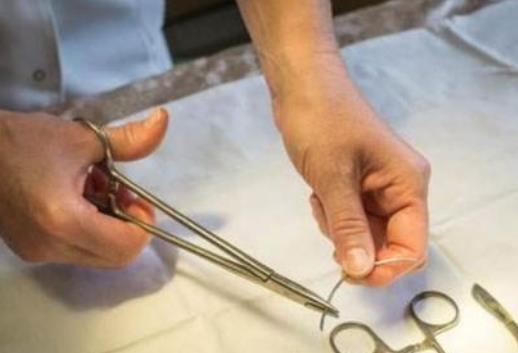 什么是結(jié)扎?男性結(jié)扎的好處有哪些?