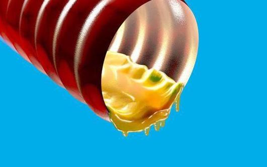 哪些人容易患支氣管擴張?引起支氣管擴張的病因