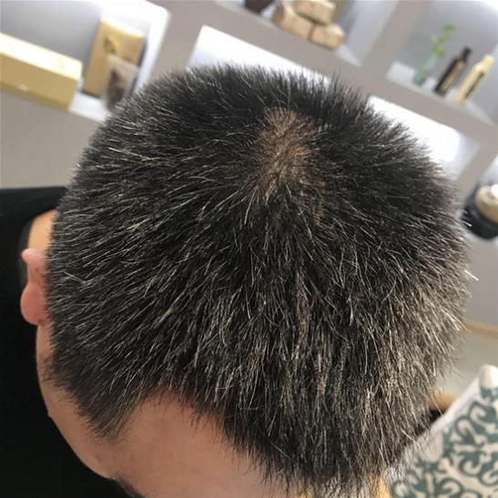 原來脫發白頭發和它有關,這個東西能讓白發變黑!