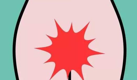 外陰瘙癢會引起哪些并發癥?外陰瘙癢需要注意什么?