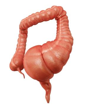 先天性巨結腸能根治嗎?先天性巨結腸的癥狀是什么
