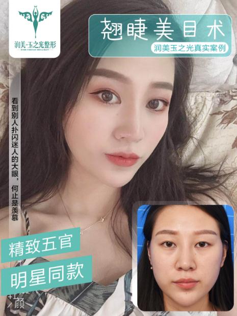 成都潤美玉之光羅通貴:豐富的手術經驗和高標準的審美理念