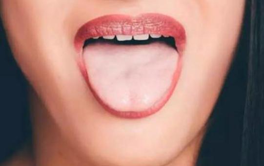 什么是胖大舌?哪些疾病會引起胖大舌?