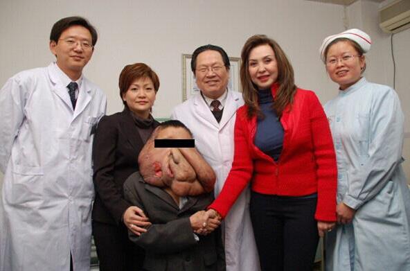 廣州腫瘤專家,黃春才成功治療案例