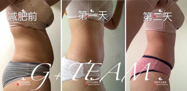 不節食不運動!每天一顆,永遠告別大肚腩!