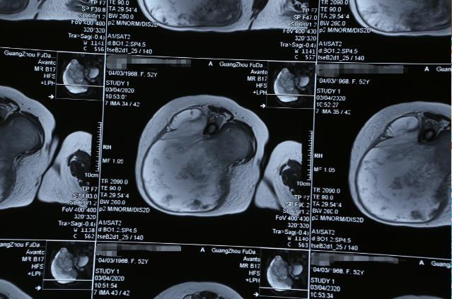 暨南大學附屬復大腫瘤醫院:最沉穩的背影,為生命而“站”