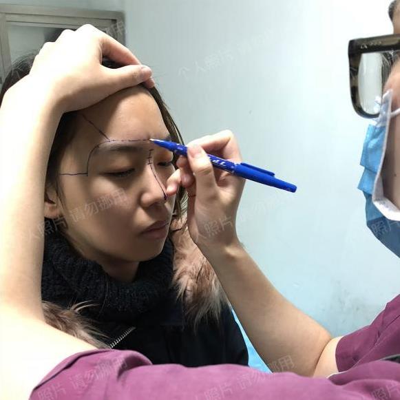 武漢楊水斌做肋軟骨鼻綜合怎么樣?來看看精品案例更直觀!