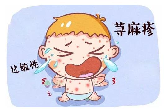 小兒麻疹該如何治療?麻疹有什么危害?