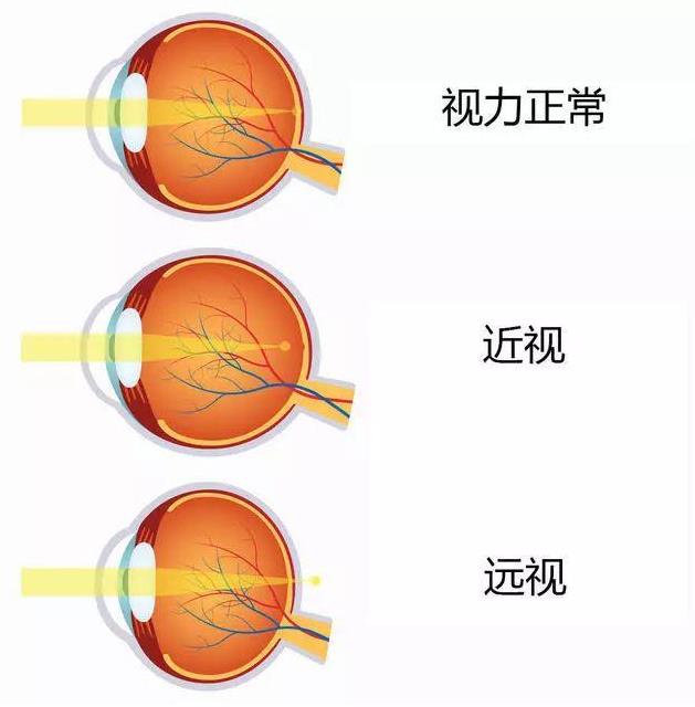 2021征兵即將開始 鄭州尖峰眼科助您實現(xiàn)軍旅夢