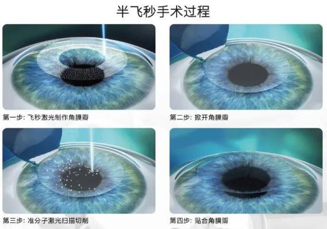 2021征兵即將開始 鄭州尖峰眼科助您實現(xiàn)軍旅夢