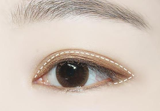 眼瞼上長小顆粒是為什么?為什么下眼瞼有一個小洞?