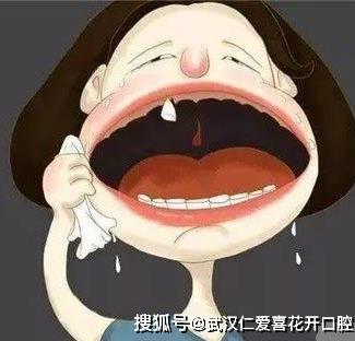 武漢仁愛口腔上頜牙間斷種植牙修復,未來口齒不漏風