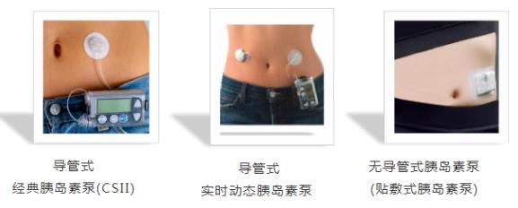 微泰醫療既有貼泵又有CGM,熱度不斷,或成業界黑馬!