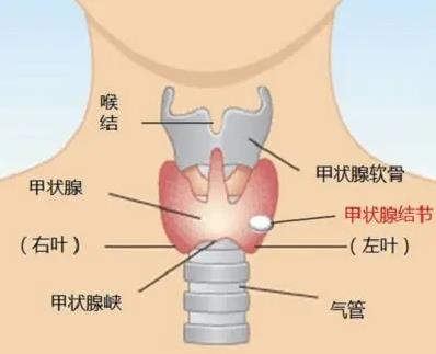 甲狀腺結多大算正常范圍之內?武漢民生耳鼻喉醫院24h在線免費咨詢預約
