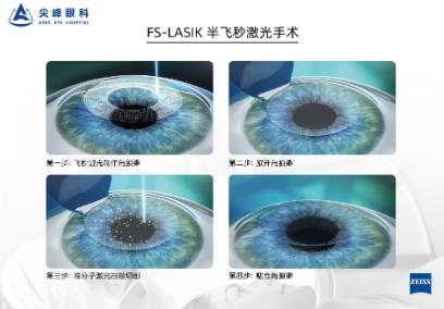 鄭州尖峰眼科:近視參軍適合做哪種近視手術?