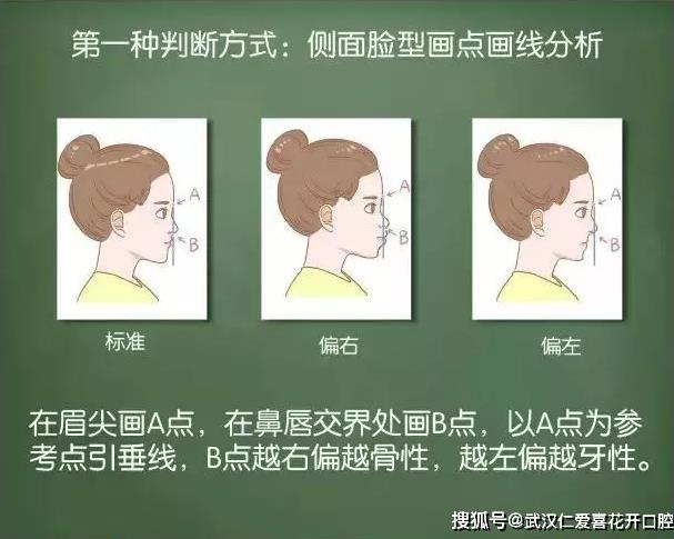 “一張嘴毀掉所有”的突嘴,該如何拯救?武漢仁愛口腔牙齒矯正讓你瞬間綻放笑容!